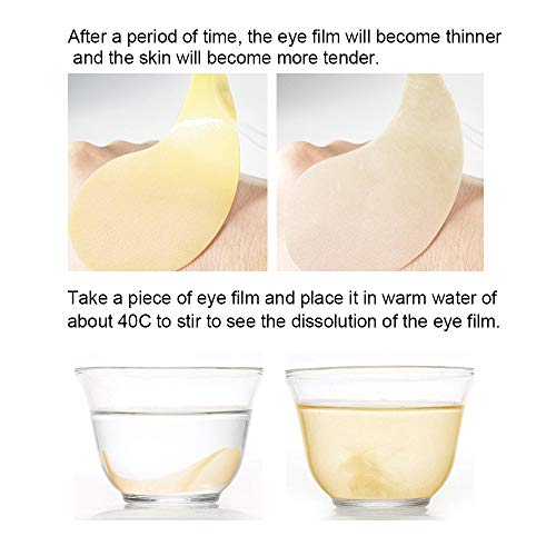 מסכות לטיפול בעיניים זהב U.VMREE - תחת טלאי עיניים, עיגולים כהים תחת טיפול בעיניים, מתחת לטיפול בשקיות עיניים, מסיכת עיניים לעיניים נפוחות,