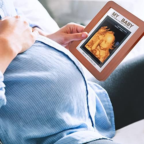 מסגרת תמונה של סונוגרמה לתינוק אולטרסאונד מסגרת תמונה הודעת הריון